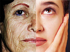 Exoderm peel Exoderm Medical Centers 